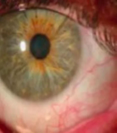 Ophthalmologist in Bayside