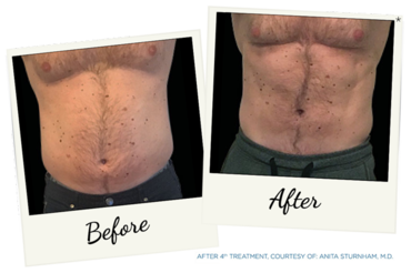 New York Cornea Consultants | Glaucoma, Diabetic Retinopathy and Macular Degeneration