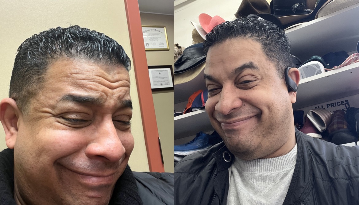 New York Cornea Consultants | OMNI trade  Glaucoma Treatment System, Keratoconus and PRP for Under Eyes