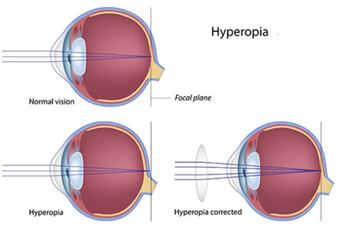 Ophthalmologist 11361