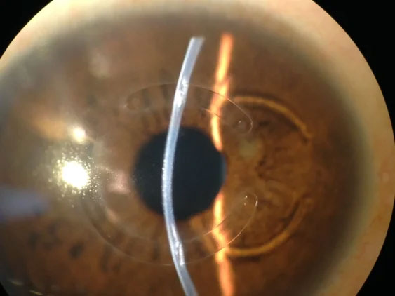 Ophthalmology Office near Bayside